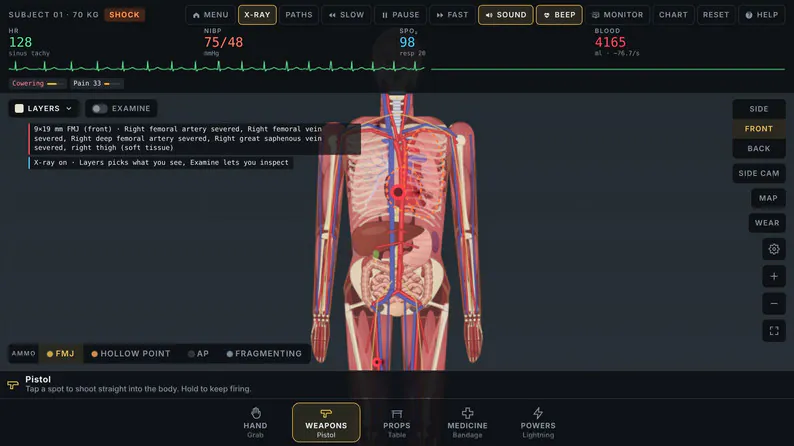 Anatomy model in X-Ray view with Layers and Examine controls visible.